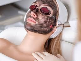 Does Laser Carbon Peel Shrink Large Pores?